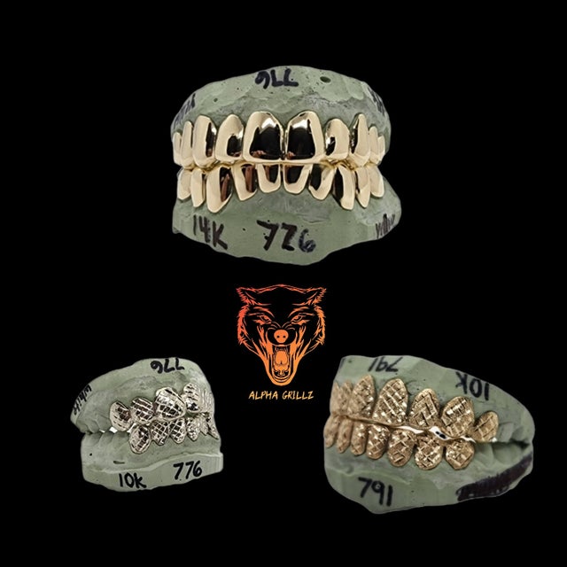 custom grillz teeth near me Alpha Grillz
